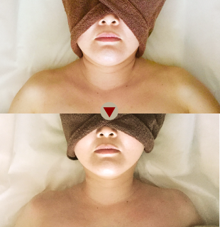 ノットノットの写真ギャラリー ビフォーアフター before after ノットノットの結果を引き出す施術