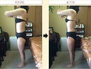 ビフォーアフター<施術１回>