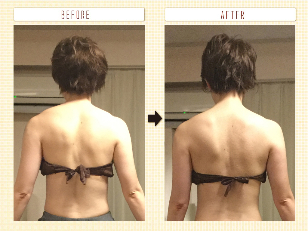 ビフォーアフター<施術１回>